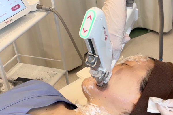 水光注射bellapro（ベラプロ）