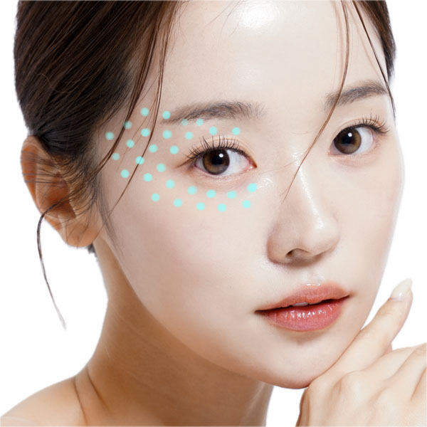 プロファイロ注入ポイント