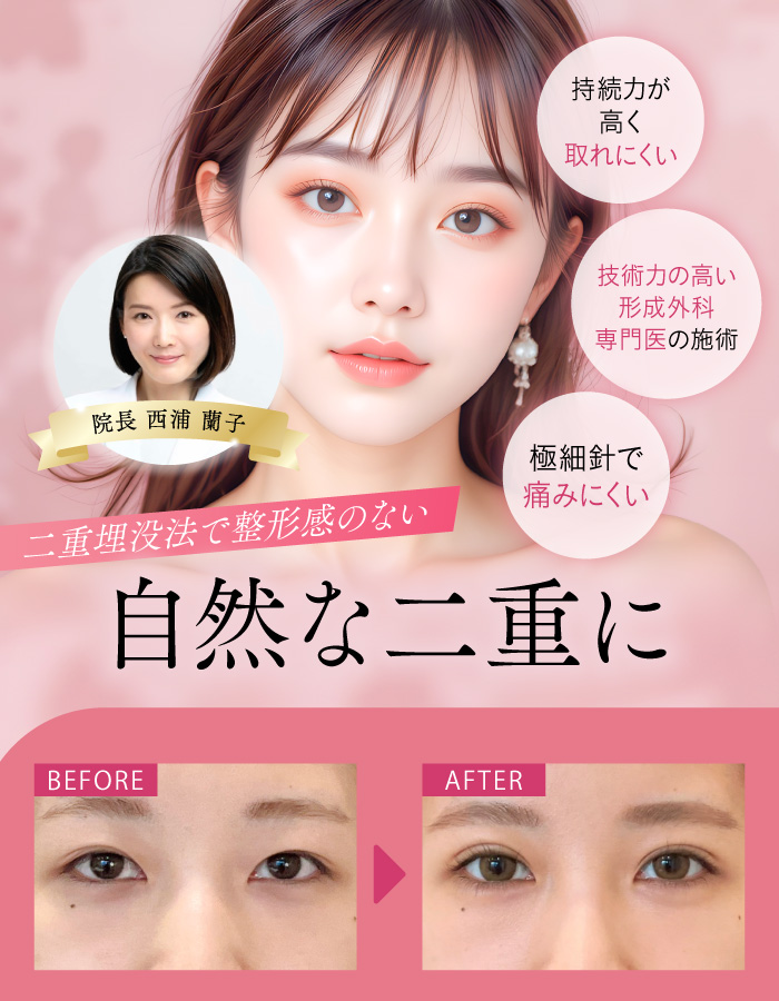 二重埋没法